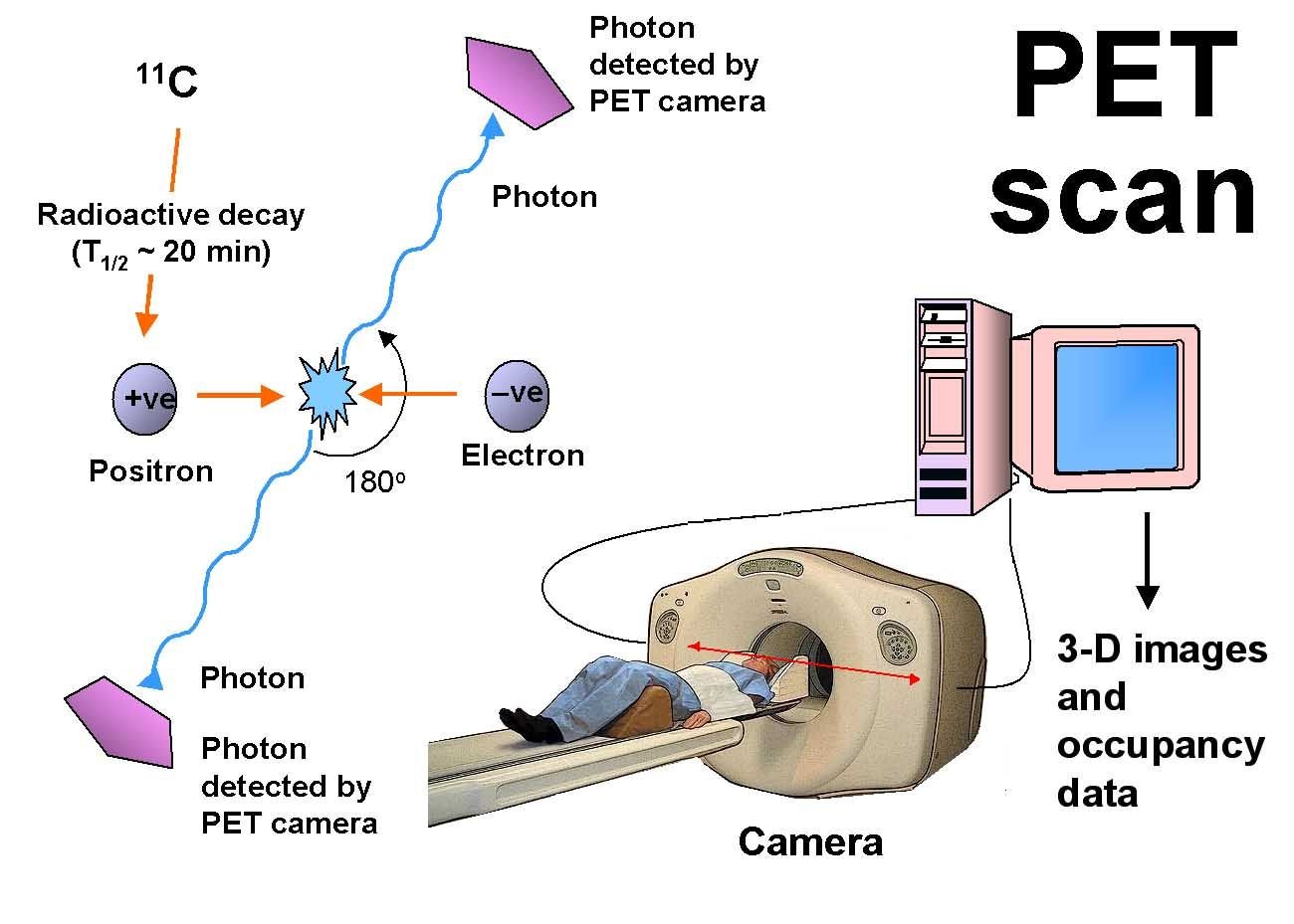 Aparelho de PET scan