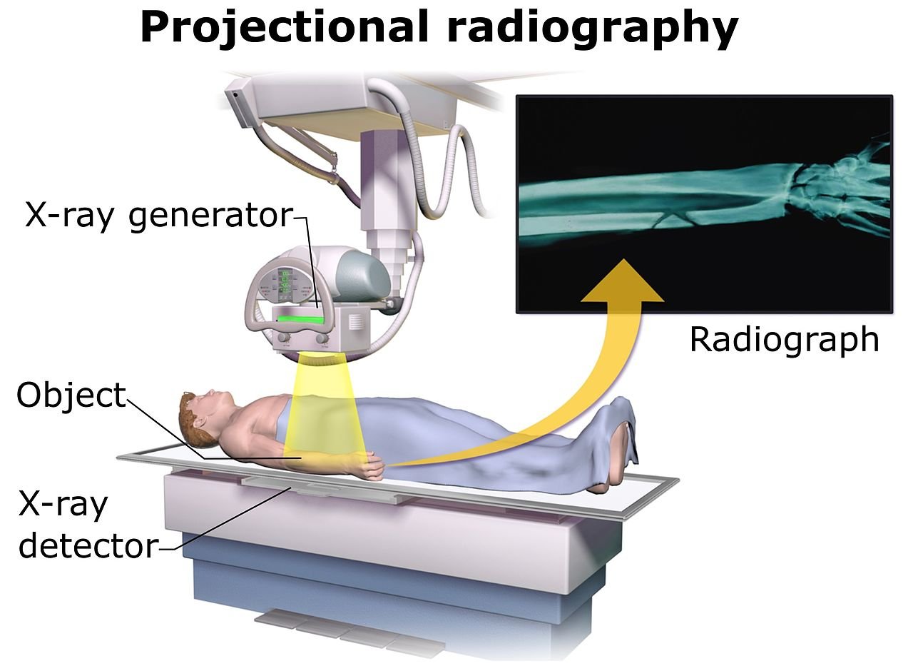 Radiografia